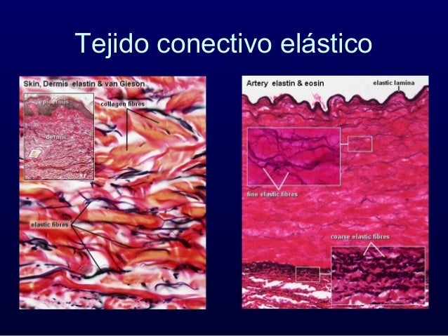 Tejido conectivo