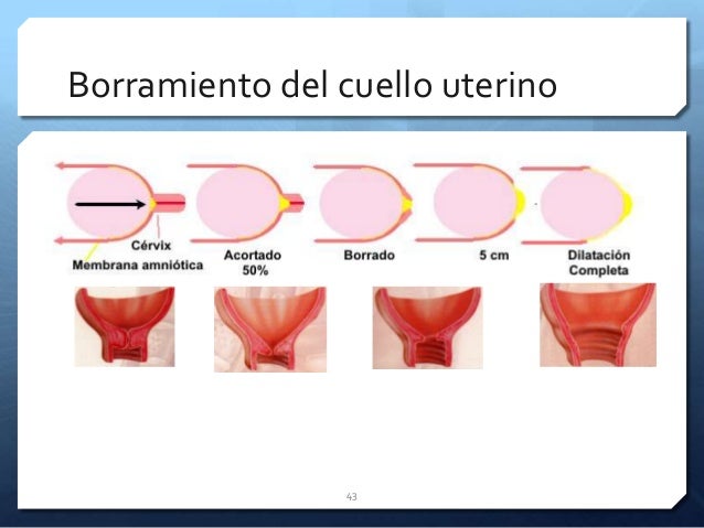 Teorías del trabajo de parto