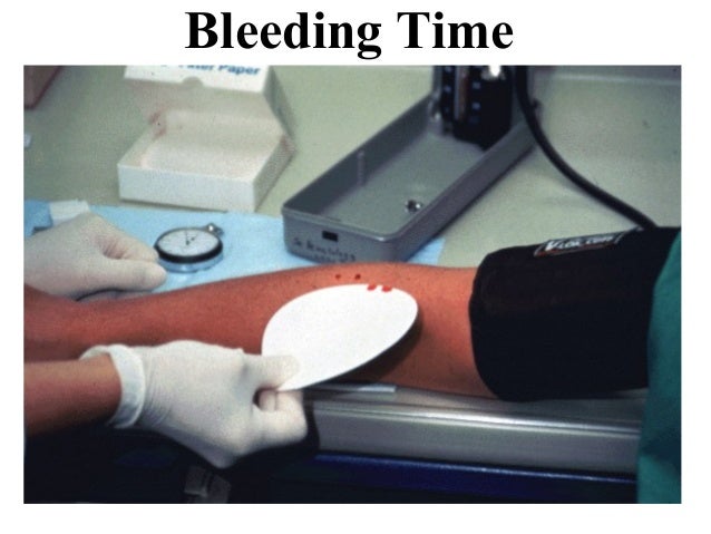 Image result for bleeding time duke method