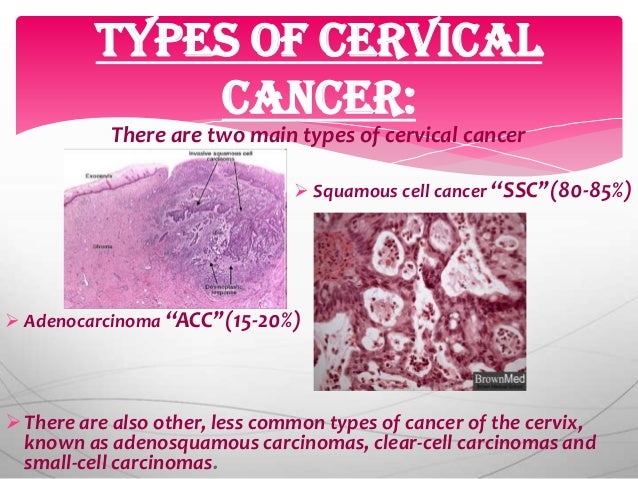 endometrial cancer holistic treatment
