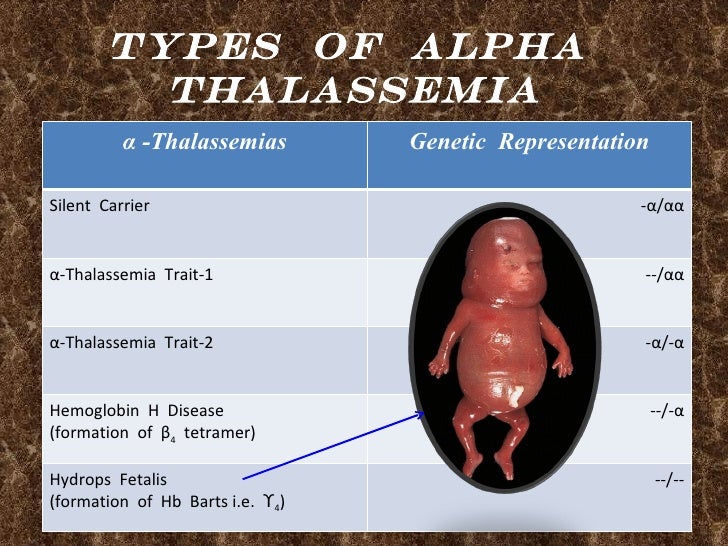 Thalassemia Avik