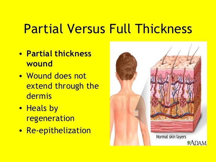 The 411 on wound care