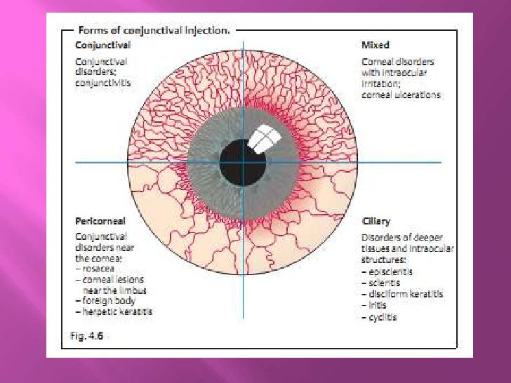 opthalmolgy.The conjunctiva lecture 1.(dr.ali)