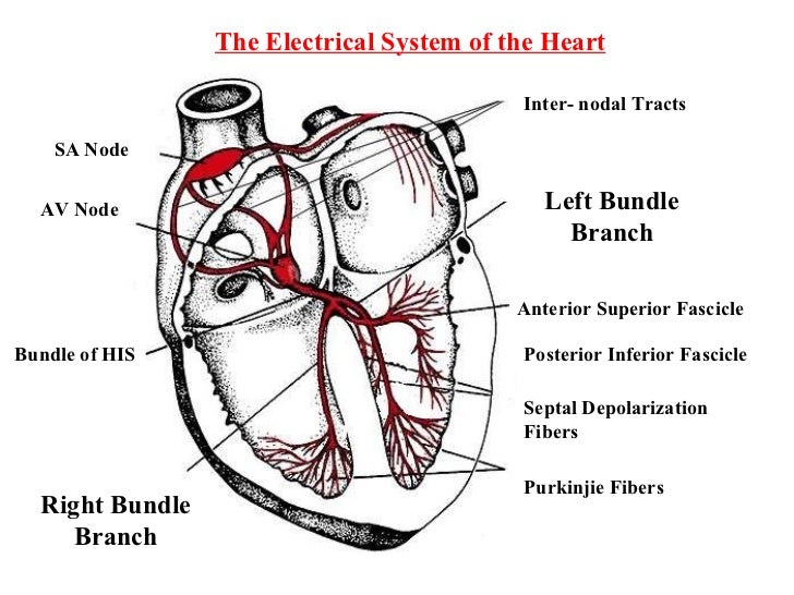 EKGs you don’t know bifascicular block SinaiEM