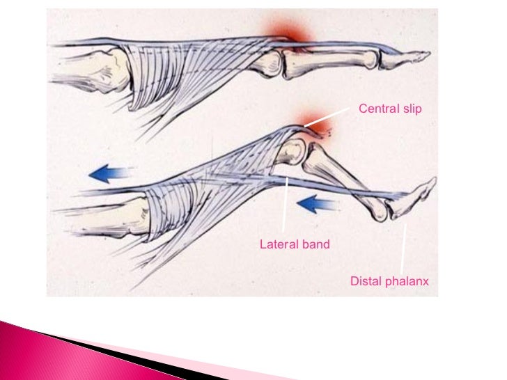 The Hand Anatomy Part 2
