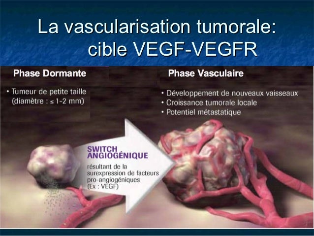 alimentation most cancers orl leucémie aigue espérance de vie