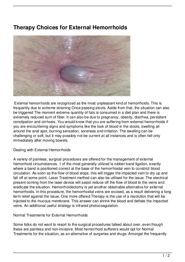 Hemorrhoids being pregnant what do hemorrhoids appear to be