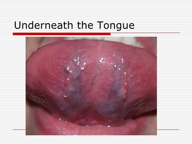 What Does Baking Soda Under The Tongue Do The Tongue!!