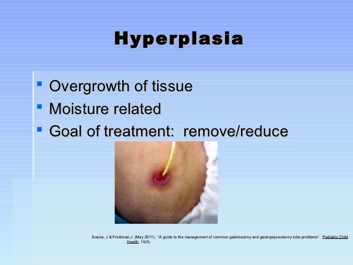 Those troublesome tube swithsponsors