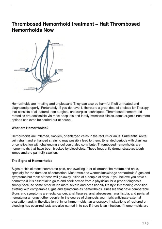 Thrombosed Hemorrhoid treatment Halt Thrombosed Hemorrhoids Now