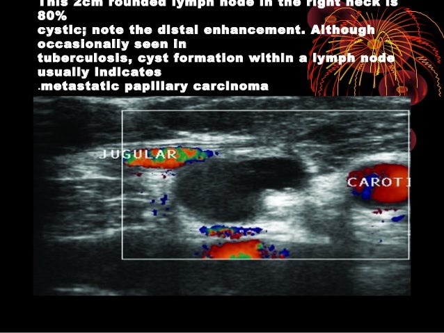very early signs and symptoms of cervical cancer