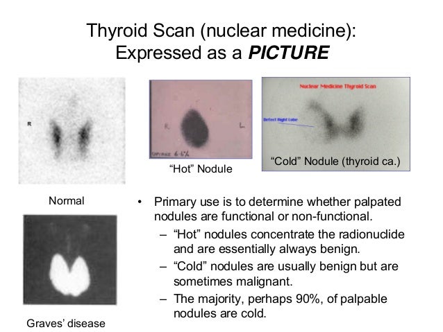 thyroid thyroid