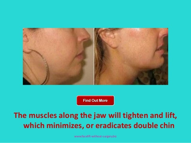 Best Facial Exercise Program 2