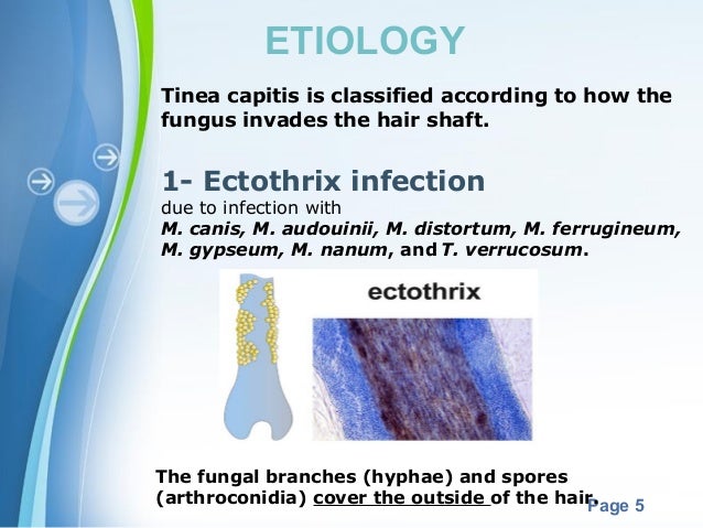 Ringworm of the Body (Tinea Corporis) - Healthline