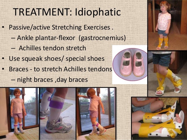 special shoes for tip toe walkers