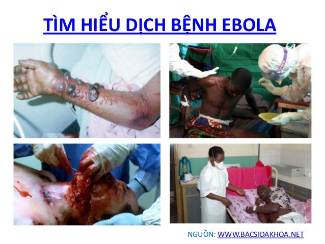 Image result for Benh Ebola