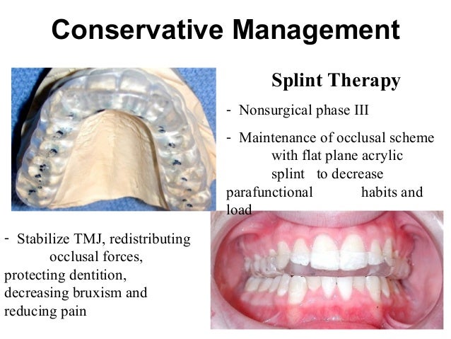 TMJ Anatomy TMJ Anatomy