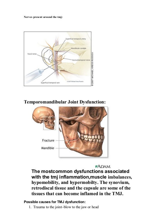 Tmj dislocation
