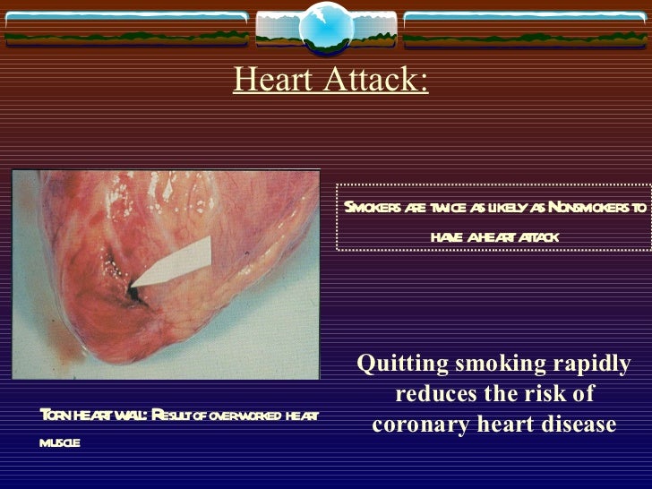 quit smoking essay papers Smoking essays / the links between smoking and panic disorder healthcentralcom printed an article citing smoking as a cause of panic attacks in this article, reuters health states that daily smokers are more likely than nonsmokers to experience a panic attack for the first time. quit smoking essay papers Smoking essays / the links between smoking and panic disorder healthcentralcom printed an article citing smoking as a cause of panic attacks in this article, reuters health states that daily smokers are more likely than nonsmokers to experience a panic attack for the first time.