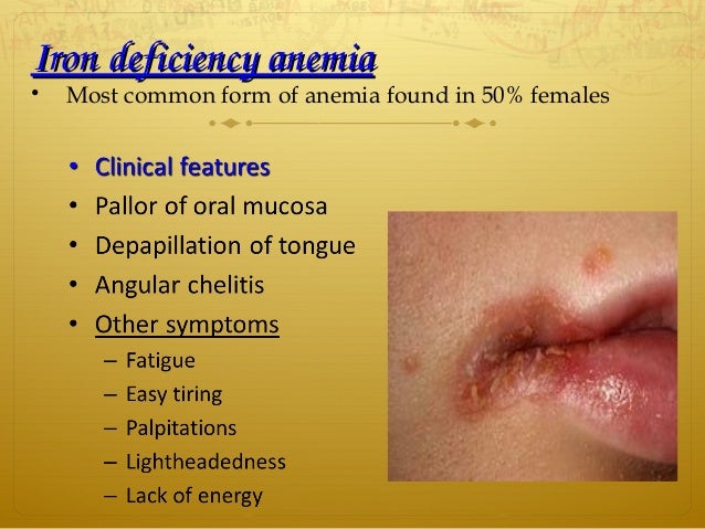 Iron Deficiency...