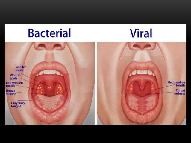 tonsils Xxx deep throat
