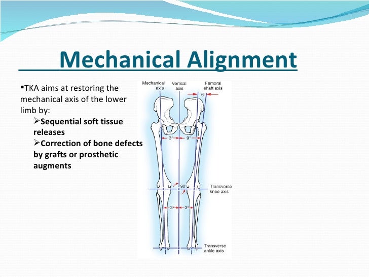Total knee replacement (tkr) ppt