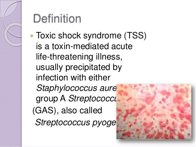 Toxic Shock Syndrome: Symptoms, Diagnosis, and Treatment