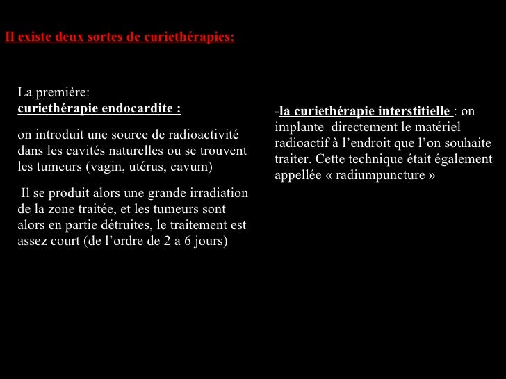 Los angeles Curiethérapie Interstitielle