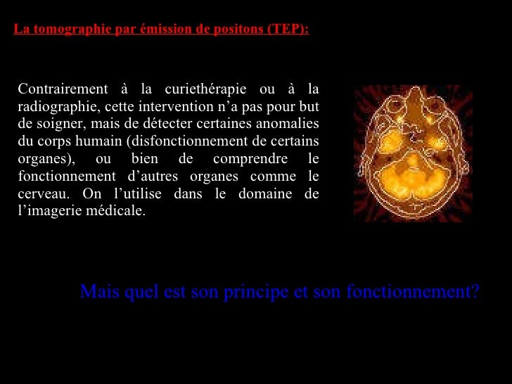 Curiethérapie Fonctionnement