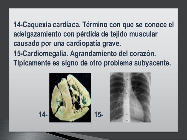 Mono el régimen para el adelgazamiento que esto