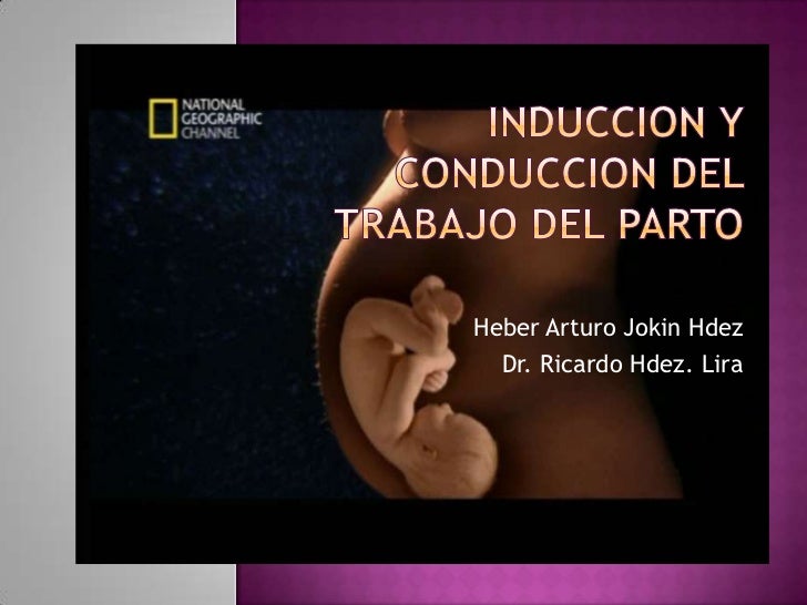INDUCCION TRABAJO PARTO induccion trabajo parto: