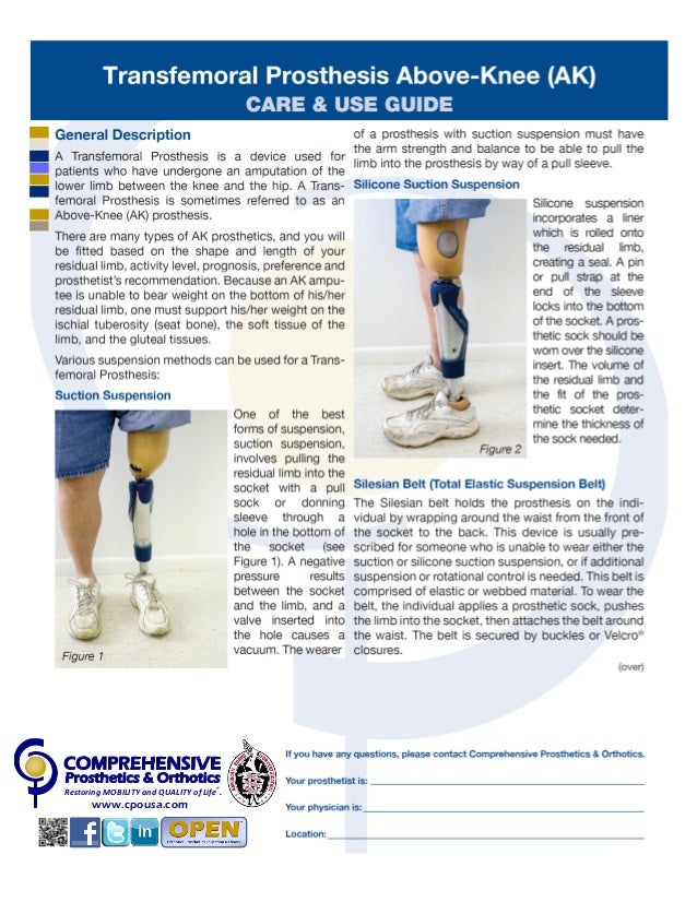 Transfemoral Prosthesis Above Knee (AK) CARE AND USE GUIDE