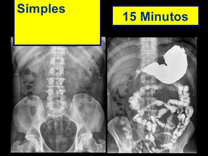 Transito intestinal exame