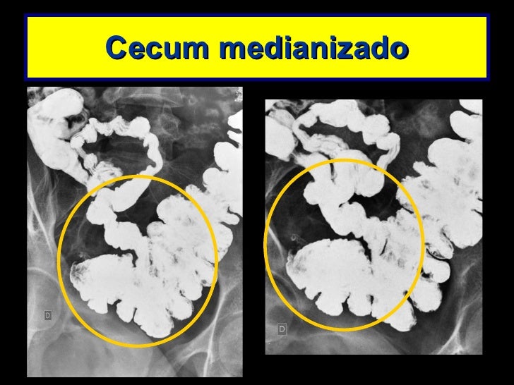 Transito intestinal exame