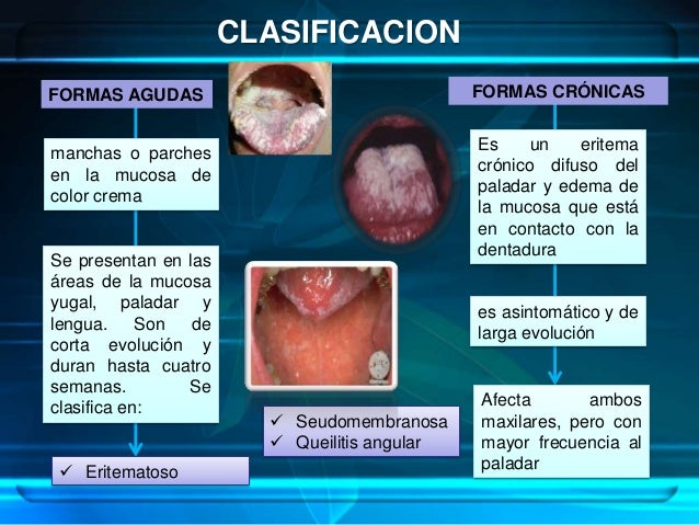 El hongo de las uñas en los pies los mejores medios