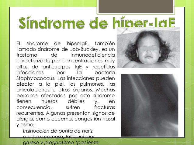 A que médico dirigirse a la psoriasis de las uñas