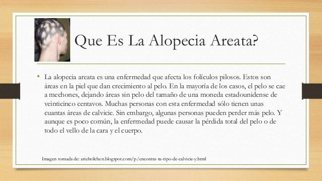 Que es mejor el aceite de bardana para los cabellos