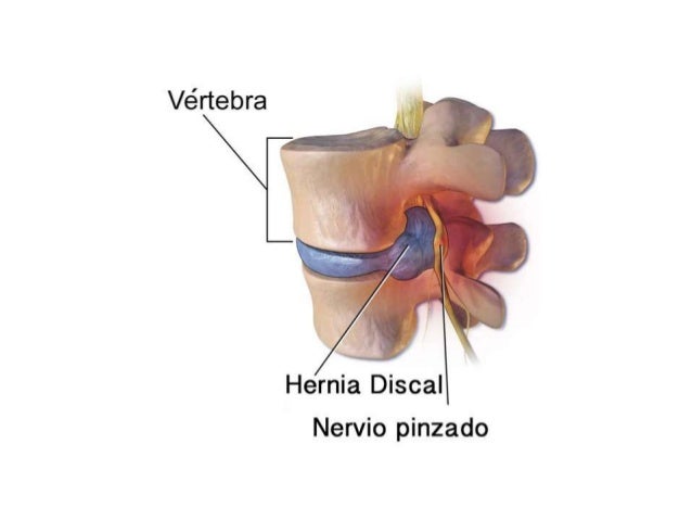 El ungüento contra el hongo de las orejas