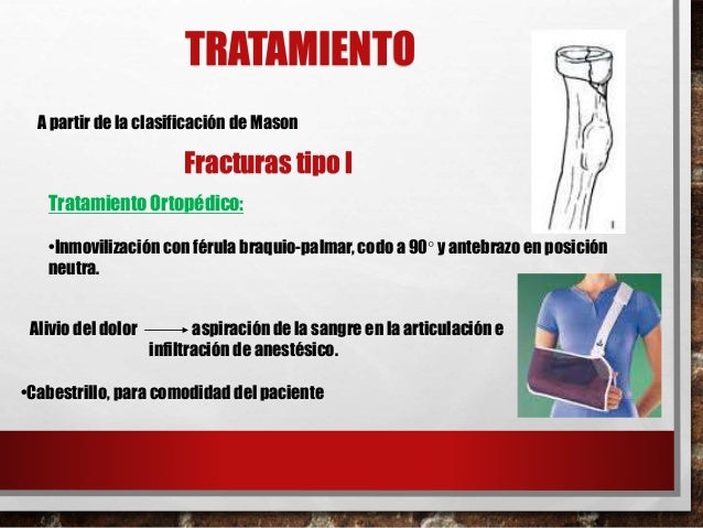FRACTURA RADIO fractura radio: