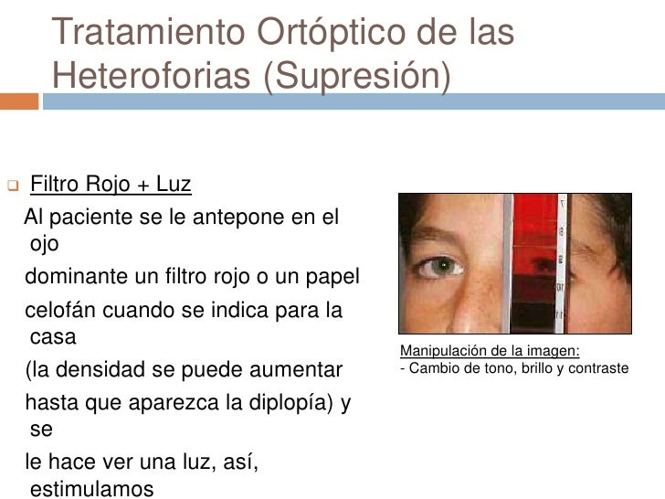 Ejercicios Ortopticos Para Hacer En Casa