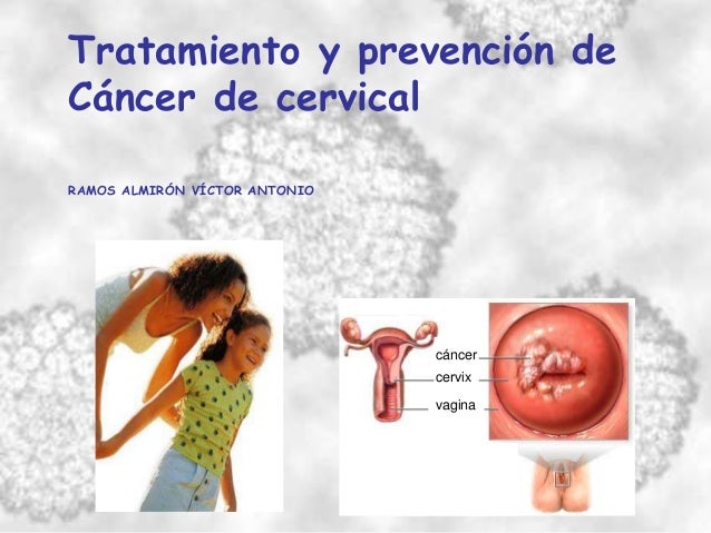 Tratamiento De Cancer Guatemala