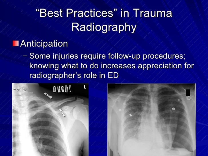 Trauma Radiography