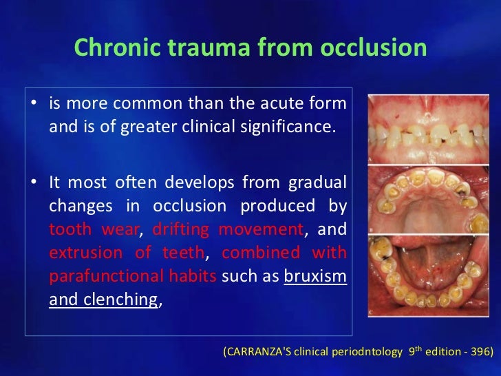 Trauma from occlusion