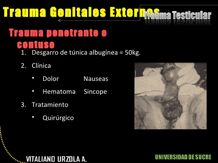 Trauma genital externo