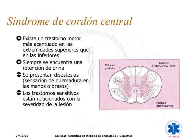Traumatismos de Columna Vertebral