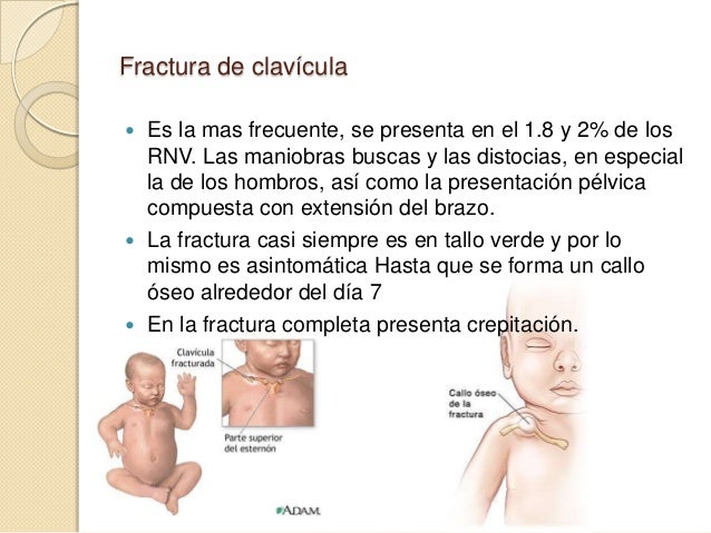 Traumatismos del parto
