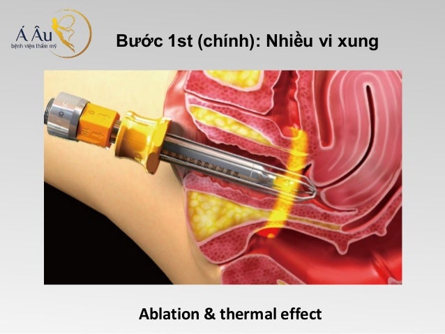 [Image: slide-6-638.jpg?cb=1392631590]