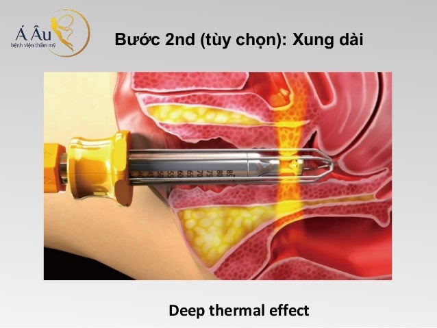 [Image: slide-7-638.jpg?cb=1392631590]