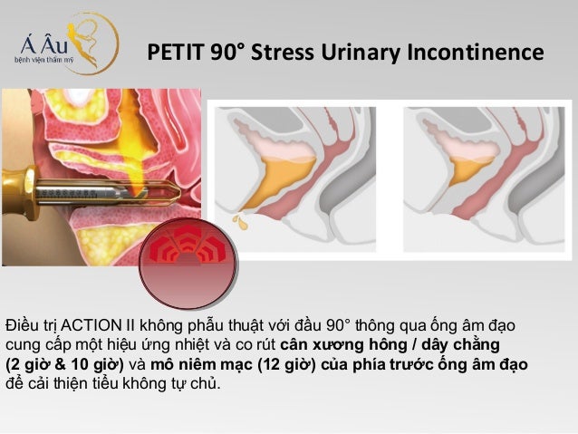 [Image: slide-8-638.jpg?cb=1392631590]