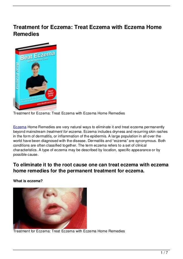 Ayurvedic Remedies to Get Rid of Stretch Marks picture picture Ayurvedic Remedies to Get Rid of Stretch Marks